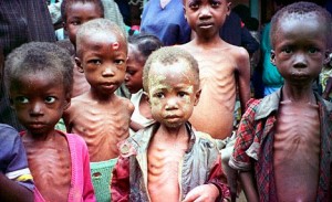 enfants et la faim La Somalie est l'une des pires catastrophes humanitaires du monde, avec des centaines de milliers de personnes déplacées en raison du conflit. Maintenant, une sécheresse prolongée est l'ajout de nombreux problèmes du pays.